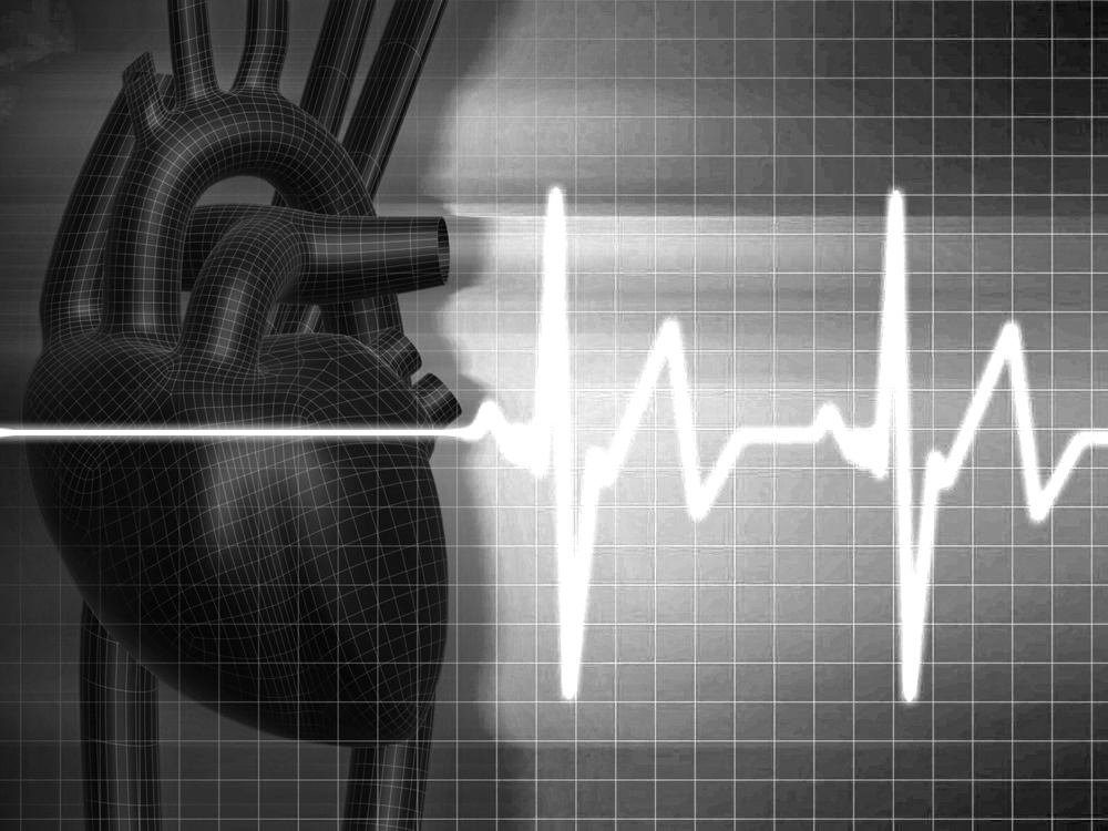 Cardiovascular2
